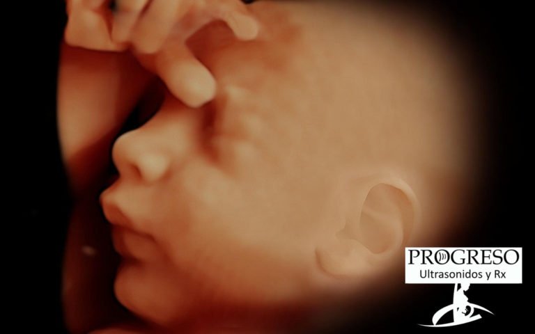 Como es un Ultrasonidos. Ultrasonido Progreso