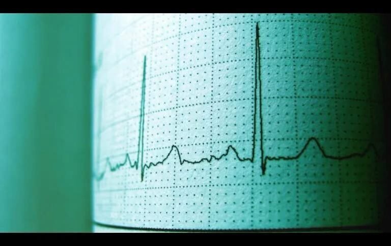 Sismo de 7.7 sacude Indonesia y activa alerta de tsunami en varias provincias